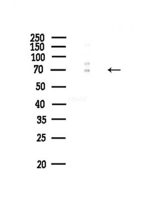 Phospho-eIF4B (Ser504) Antibody - Western blot analysis of lysates from COLO205 cells(heat-shock,45min treatment), using Phospho-eIF4B (Ser504) Antibody at 1/1000 dilution.