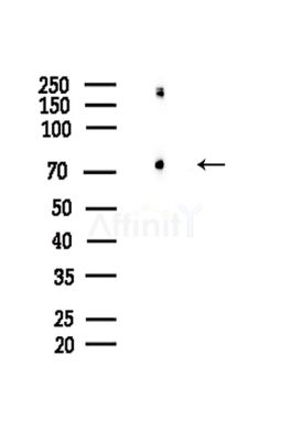 Phospho-eIF4B (Ser504) Antibody - Western blot analysis of lysates from Hela cells(LPS,4h treatment), using Phospho-eIF4B (Ser504) Antibody at 1/1000 dilution.