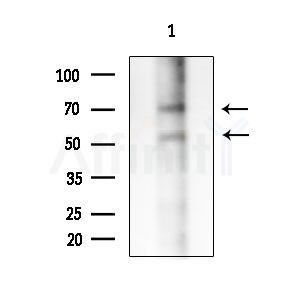Phospho-TFEB (Ser211) Antibody - Western blot analysis of extracts from Rat lung, using Phospho-TFEB (Ser211) Antibody at 1/1000 dilution.