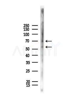 Phospho-TFEB (Ser211) Antibody - Western blot analysis of lysates from Rat lung, using Phospho-TFEB (Ser211) Antibody at 1/1000 dilution.