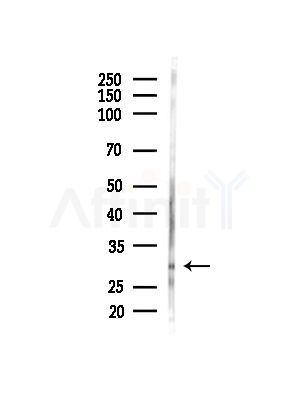 Phospho-GAP43 (Ser41) Antibody - Western blot analysis of lysates from HUVEC cells(starvation,24h treatment), using Phospho-GAP43 (Ser41) Antibody at 1/1000 dilution.