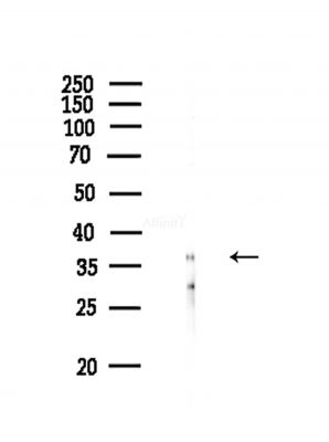 Phospho-Nucleophosmin (Ser125) Antibody - Western blot analysis of lysates from COLO205 cells(heat-shock,45min treatment), using Phospho-Nucleophosmin (Ser125) Antibody at 1/1000 dilution.