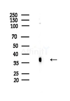 Phospho-Nucleophosmin (Ser125) Antibody - Western blot analysis of lysates from Hela cells(LPS,4h treatment), using Phospho-Nucleophosmin (Ser125) Antibody at 1/1000 dilution.