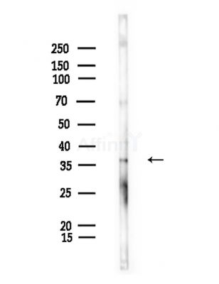 Phospho-Nucleophosmin (Ser125) Antibody - Western blot analysis of lysates from Rat liver, using Phospho-Nucleophosmin (Ser125) Antibody at 1/1000 dilution.