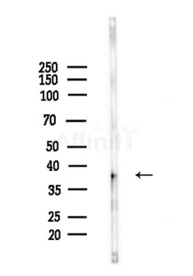 Phospho-Nucleophosmin (Ser125) Antibody - Western blot analysis of lysates from Mouse brain, using Phospho-Nucleophosmin (Ser125) Antibody at 1/1000 dilution.