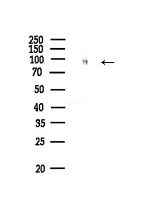 Phospho-Progesterone Receptor (Ser190) Antibody - Western blot analysis of lysates from COLO205 cells(heat-shock,45min treatment), using Phospho-Progesterone Receptor (Ser190) Antibody at 1/1000 dilution.