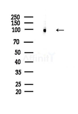 Phospho-Progesterone Receptor (Ser190) Antibody - Western blot analysis of lysates from Hela cells(LPS,4h treatment), using Phospho-Progesterone Receptor (Ser190) Antibody at 1/1000 dilution.
