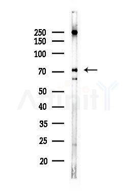 Phospho-Lamin A/C (Ser390) Antibody - Western blot analysis of lysates from Hela cells(heat-shock,45min treatment), using Phospho-Lamin A/C (Ser390) Antibody at 1/1000 dilution.
