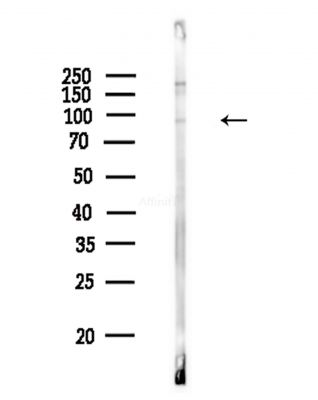 Phospho-LETM1 (Thr192) Antibody - Western blot analysis of lysates from COLO205 cells(heat-shock,45min treatment), using Phospho-LETM1 (Thr192) Antibody at 1/1000 dilution.