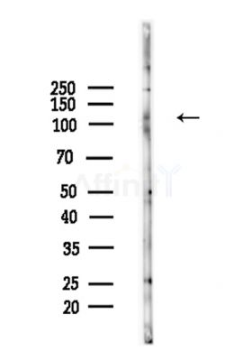 Phospho-XIRP1 (Ser295) Antibody - Western blot analysis of lysates from Mouse brain, using Phospho-XIRP1 (Ser295) Antibody at 1/1000 dilution.