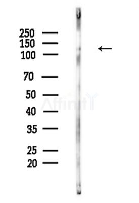 Phospho-Nephrin (Tyr1217) Antibody - Western blot analysis of lysates from Hela cells(LPS,4h treatment), using Phospho-Nephrin (Tyr1217) Antibody at 1/1000 dilution.