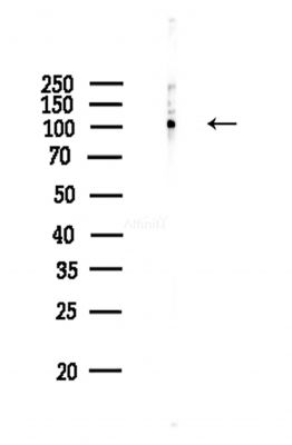 Phospho-ACTN1/2/3/4 (Ser159) Antibody - Western blot analysis of lysates from COLO205 cells(heat-shock,45min treatment), using Phospho-ACTN1/2/3/4 (Ser159) Antibody at 1/1000 dilution.