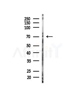 Phospho-TIF1 alpha (Ser649) Antibody - Western blot analysis of lysates from HUVEC cells(starvation,24h treatment), using Phospho-TIF1 alpha (Ser649) Antibody at 1/1000 dilution.