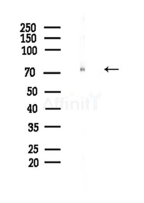 Phospho-DDX3 (Ser102) Antibody - Western blot analysis of lysates from Hela cells(LPS,4h treatment), using Phospho-DDX3 (Ser102) Antibody at 1/1000 dilution.