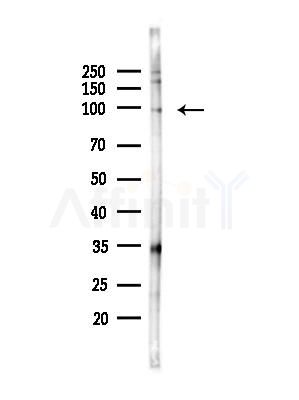 Phospho-IREB1 (Ser711) Antibody - Western blot analysis of lysates from PC12 cells(heat-shock,45min treatment), using Phospho-IREB1 (Ser711) Antibody at 1/1000 dilution.
