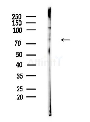 Phospho-JIP1 (Thr205) Antibody - Western blot analysis of lysates from Hela cells(LPS,4h treatment), using Phospho-JIP1 (Thr205) Antibody at 1/1000 dilution.