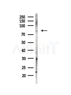 Phospho-Tau (Thr492/Thr175) Antibody - Western blot analysis of lysates from PC12 cells(heat-shock,45min treatment), using Phospho-Tau (Thr492/Thr175) Antibody at 1/1000 dilution.