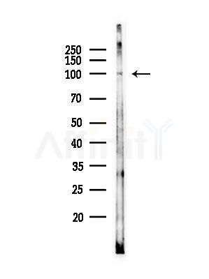 Phospho-PYGL (Ser15) Antibody - Western blot analysis of lysates from PC12 cells(heat-shock,45min treatment), using Phospho-PYGL (Ser15) Antibody at 1/1000 dilution.