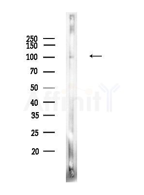 Phospho-TLR3 (Tyr858) Antibody - Western blot analysis of lysates from A375 cells(heat-shock,45min treatment), using Phospho-TLR3 (Tyr858) Antibody at 1/1000 dilution.