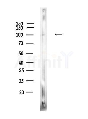 Phospho-TLR3 (Tyr858) Antibody - Western blot analysis of lysates from A375 cells(heat-shock,45min treatment), using Phospho-TLR3 (Tyr858) Antibody at 1/1000 dilution.