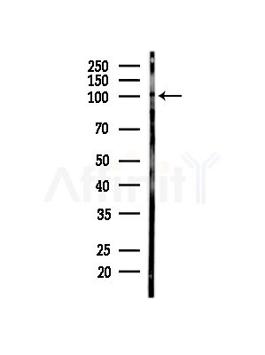 Phospho-HMGCR (Ser872) Antibody - Western blot analysis of lysates from HUVEC cells(starvation,24h treatment), using Phospho-HMGCR (Ser872) Antibody at 1/1000 dilution.