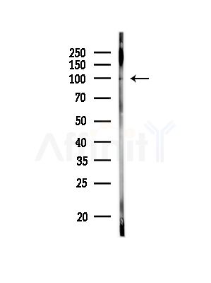 Phospho-HMGCR (Ser872) Antibody - Western blot analysis of lysates from Rat liver, using Phospho-HMGCR (Ser872) Antibody at 1/1000 dilution.