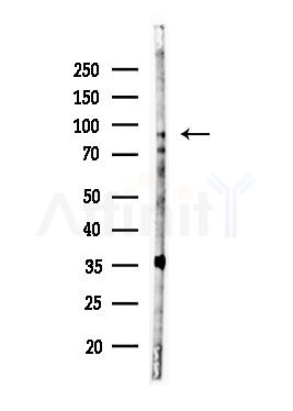 Phospho-PKD1/PKC mu (Ser205) Antibody - Western blot analysis of lysates from Hela cells(heat-shock,45min treatment), using Phospho-PKD1/PKC mu (Ser205) Antibody at 1/1000 dilution.