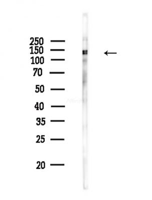 Phospho-MCM2 (Ser41) Antibody - Western blot analysis of lysates from COLO205 cells(heat-shock,45min treatment), using Phospho-MCM2 (Ser41) Antibody at 1/1000 dilution.