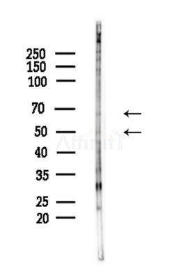 Phospho-IRF7 (Ser471/Ser472) Antibody - Western blot analysis of lysates from Hela cells(LPS,4h treatment), using Phospho-IRF7 (Ser471/Ser472) Antibody at 1/1000 dilution.