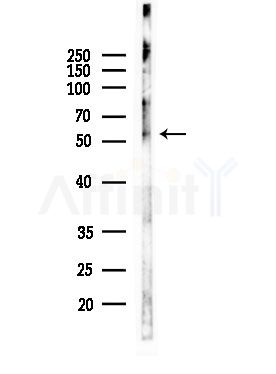 Phospho-IRF-7 (Ser437/Ser438) Antibody - Western blot analysis of lysates from COLO205 cells, using Phospho-IRF-7 (Ser437/Ser438) Antibody at 1/1000 dilution.