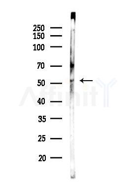 Phospho-IRF-7 (Ser437/Ser438) Antibody - Western blot analysis of lysates from Rat testis, using Phospho-IRF-7 (Ser437/Ser438) Antibody at 1/1000 dilution.