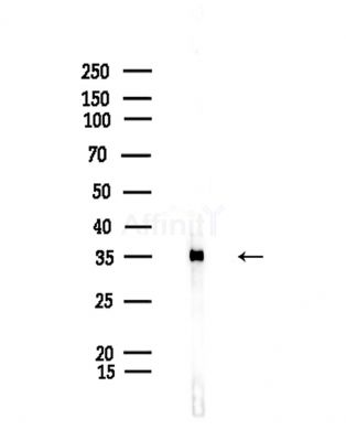 Phospho-LRRK2 (Ser910) Antibody - Western blot analysis of lysates from Rat liver, using Phospho-LRRK2 (Ser910) Antibody at 1/1000 dilution.
