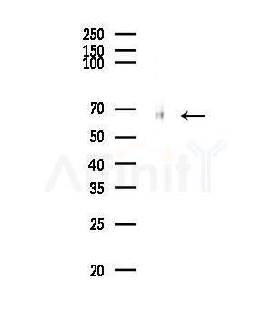 Phospho-Paxillin (Ser272) Antibody - Western blot analysis of lysates from Mouse lung, using Phospho-Paxillin (Ser272) Antibody at 1/1000 dilution.