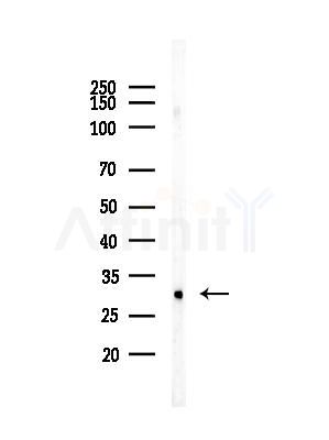 Phospho-SNAI2 (Ser104) Antibody - Western blot analysis of lysates from COLO205 cells, using Phospho-SNAI2 (Ser104) Antibody at 1/1000 dilution.
