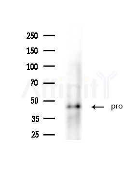 Cleaved-Caspase 1 (Asp296), p20 Antibody - Western blot analysis of extracts from Rat brain, using Cleaved-Caspase 1 (Asp296), p20 Antibody at 1/1000 dilution.