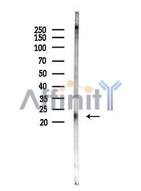 Cleaved-Caspase 1 (Asp296), p20 Antibody - Western blot analysis of extracts from Rat brain, using Cleaved-Caspase 1 (Asp296), p20 Antibody.