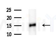 Cleaved-IL-1 beta (Asp116) Antibody - Western blot analysis of extracts from Rat brain, using Cleaved-IL-1 beta (Asp116) Antibody at 1/1000 dilution.
