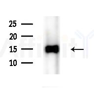 Cleaved-IL-1 beta (Asp116) Antibody - Western blot analysis of extracts from Mouse liver, using Cleaved-IL-1 beta (Asp116) Antibody at 1/1000 dilution.