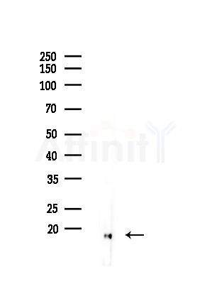 Cleaved-IL-1 beta (Asp116) Antibody - Western blot analysis of lysates from Mouse liver, using Cleaved-IL-1 beta (Asp116) Antibody at 1/1000 dilution.