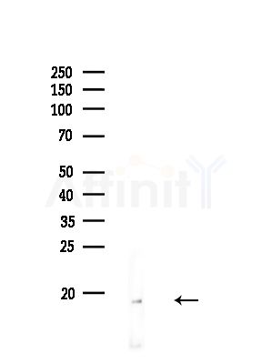 Cleaved-IL-1 beta (Asp116) Antibody - Western blot analysis of lysates from Rat brain, using Cleaved-IL-1 beta (Asp116) Antibody at 1/1000 dilution.