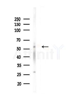 GSDMD Antibody - Western blot analysis of lysates from Mouse testis, using GSDMD Antibody at 1/1000 dilution.