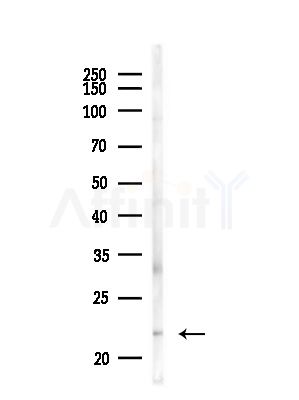 Cleaved-Caspase 7 (Asp198) Antibody - Western blot analysis of lysates from MDA-MB-231 cells(heat-shock,45min treatment), using Cleaved-Caspase 7 (Asp198) Antibody at 1/1000 dilution.