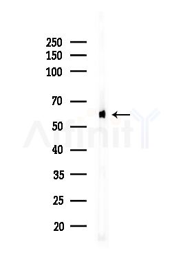 PKM2 Antibody - Western blot analysis of lysates from HUVEC cells(UV,30min treatment), using PKM2 Antibody at 1/1000 dilution.