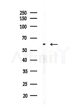 PKM2 Antibody - Western blot analysis of lysates from Hela cells(starvation,24h treatment), using PKM2 Antibody at 1/1000 dilution.