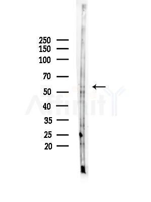 Ring1A Antibody - Western blot analysis of lysates from COLO205 cells(heat-shock,45min treatment), using Ring1A Antibody at 1/1000 dilution.