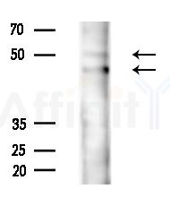 WASP Antibody - Western blot analysis of lysates from COLO205 cells(heat-shock,45min treatment), using WASP Antibody at 1/1000 dilution.