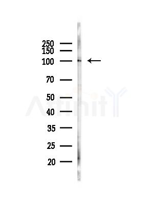 Blimp-1 Antibody - Western blot analysis of lysates from COS-7 cells(heat-shock,45min treatment), using Blimp-1 Antibody at 1/1000 dilution.