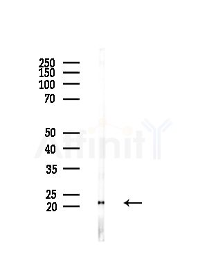 Twist2 Antibody - Western blot analysis of lysates from Hela cells(heat-shock,45min treatment), using Twist2 Antibody at 1/1000 dilution.
