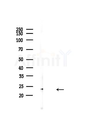 Twist2 Antibody - Western blot analysis of lysates from A375 cells(LPS,4h treatment), using Twist2 Antibody at 1/1000 dilution.