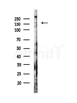 Phospho-ROCK1 (Ser282) Antibody - Western blot analysis of lysates from COLO205 cells, using Phospho-ROCK1 (Ser282) Antibody at 1/1000 dilution.